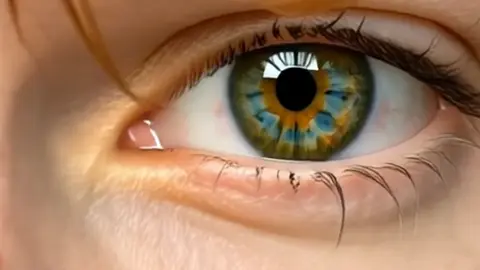 Eye Zoom Challenge